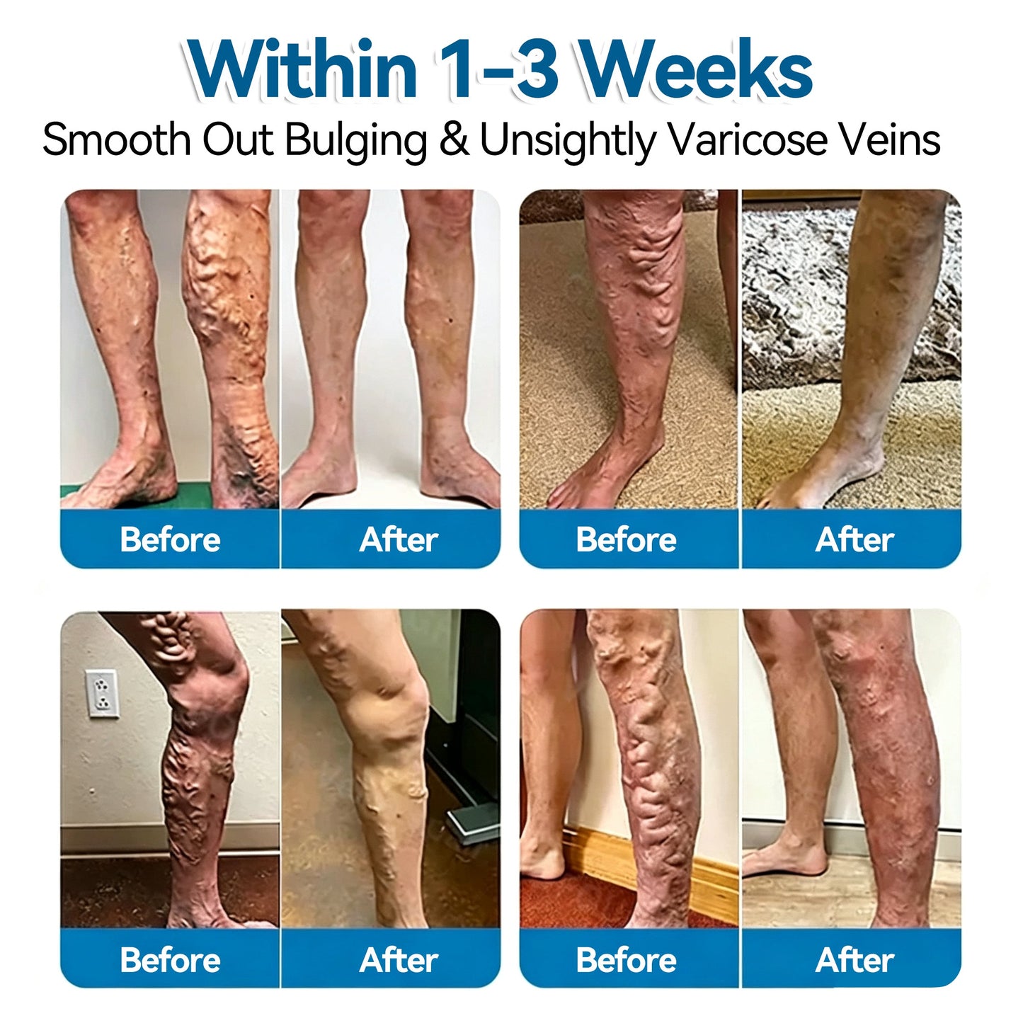 🏆✅️🎈𝐕𝐞𝐢𝐧𝐑𝐞𝐩𝐚𝐢𝐫 𝐌𝐢𝐜𝐫𝐨𝐧𝐞𝐞𝐝𝐥𝐞 𝐏𝐚𝐭𝐜𝐡 𝐑𝐨𝐥𝐥⚡Instant Relief, Long-Term Results