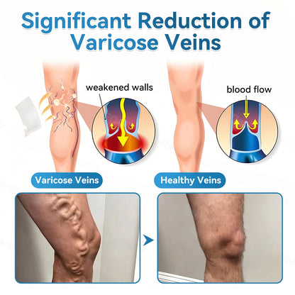 🏆✅️🎈𝐕𝐞𝐢𝐧𝐑𝐞𝐩𝐚𝐢𝐫 𝐌𝐢𝐜𝐫𝐨𝐧𝐞𝐞𝐝𝐥𝐞 𝐏𝐚𝐭𝐜𝐡 𝐑𝐨𝐥𝐥⚡Instant Relief, Long-Term Results