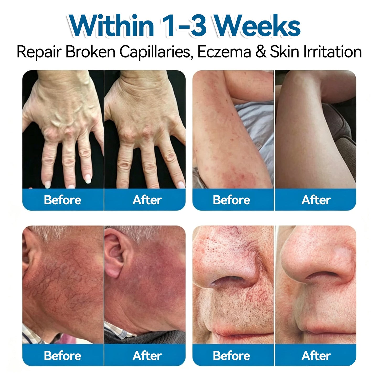 🏆✅️🎈𝐕𝐞𝐢𝐧𝐑𝐞𝐩𝐚𝐢𝐫 𝐌𝐢𝐜𝐫𝐨𝐧𝐞𝐞𝐝𝐥𝐞 𝐏𝐚𝐭𝐜𝐡 𝐑𝐨𝐥𝐥⚡Instant Relief, Long-Term Results