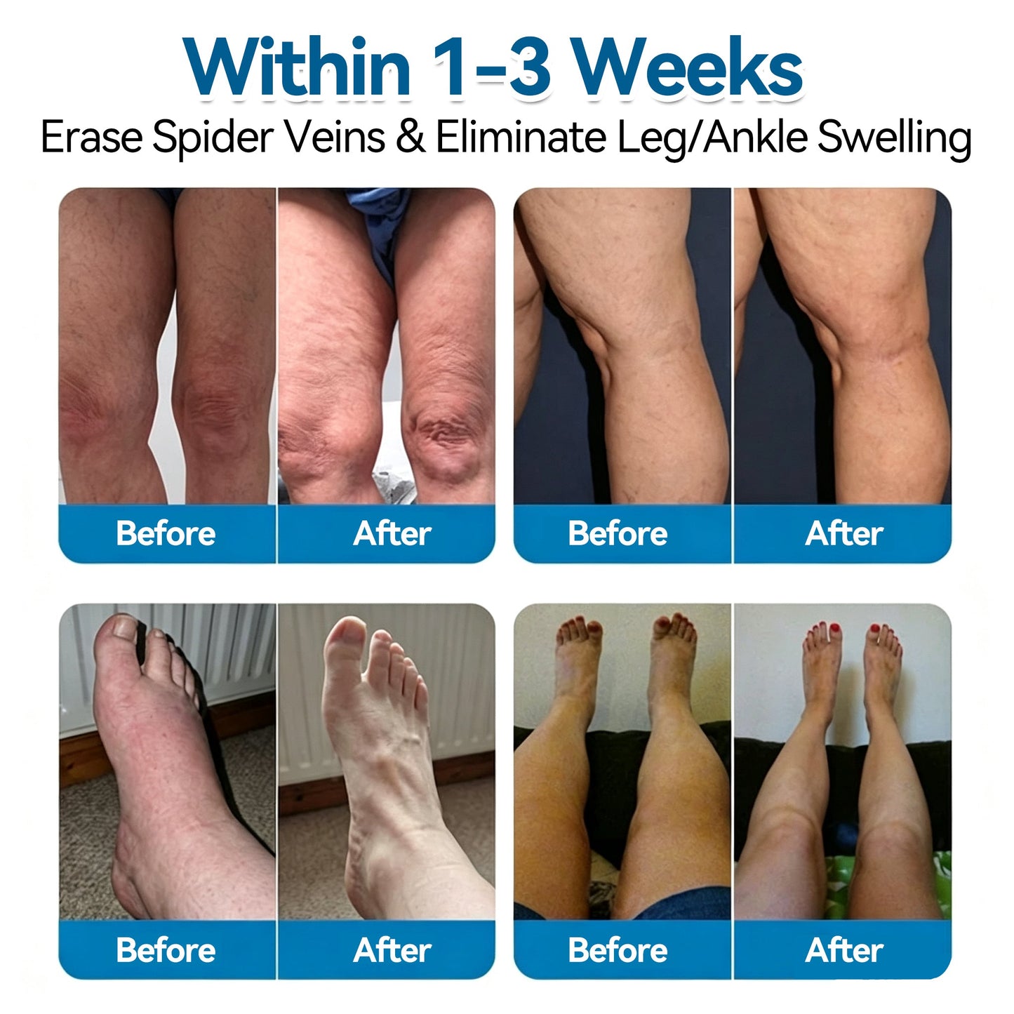 🏆✅️🎈𝐕𝐞𝐢𝐧𝐑𝐞𝐩𝐚𝐢𝐫 𝐌𝐢𝐜𝐫𝐨𝐧𝐞𝐞𝐝𝐥𝐞 𝐏𝐚𝐭𝐜𝐡 𝐑𝐨𝐥𝐥⚡Instant Relief, Long-Term Results