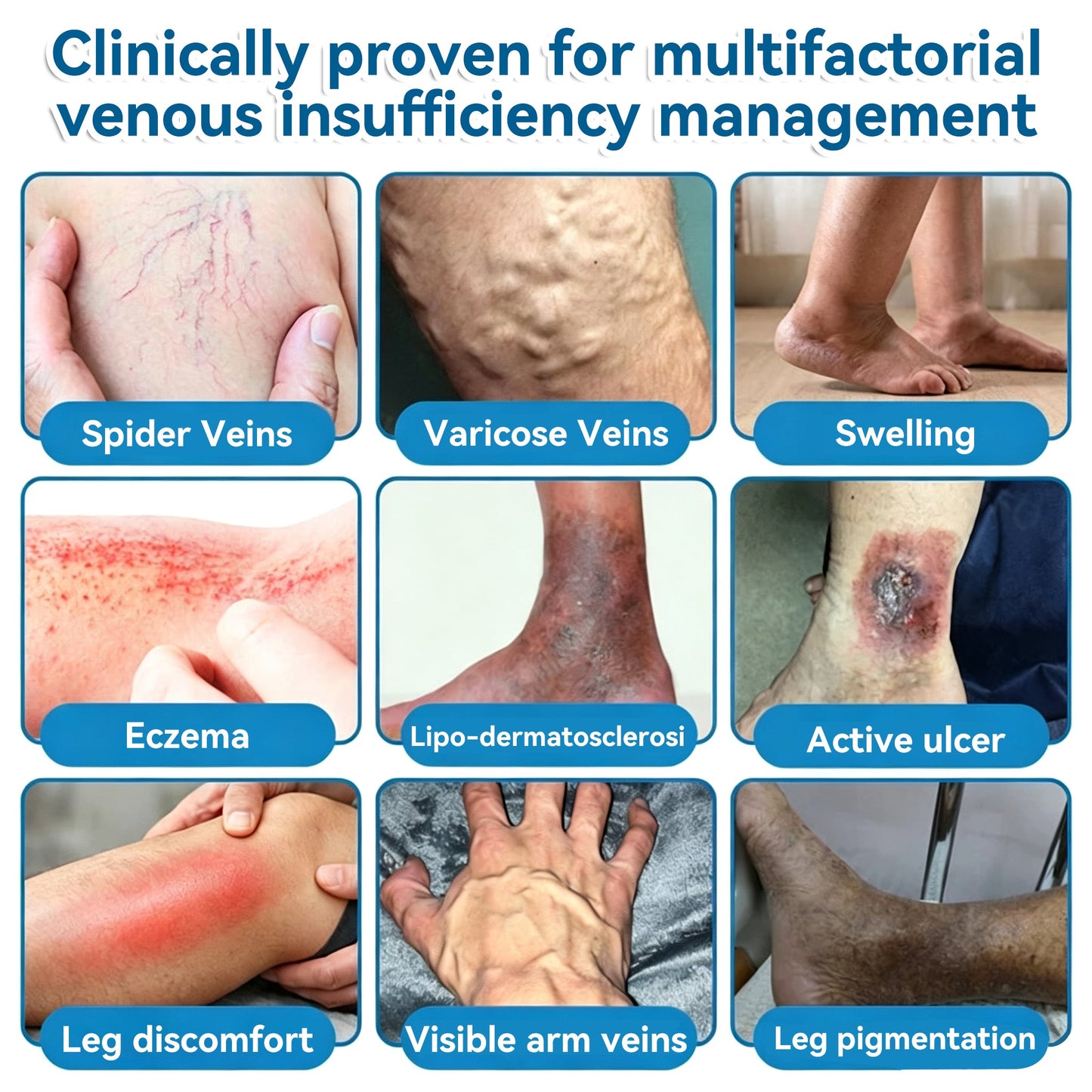 🏆✅️🎈𝐕𝐞𝐢𝐧𝐑𝐞𝐩𝐚𝐢𝐫 𝐌𝐢𝐜𝐫𝐨𝐧𝐞𝐞𝐝𝐥𝐞 𝐏𝐚𝐭𝐜𝐡 𝐑𝐨𝐥𝐥⚡Instant Relief, Long-Term Results