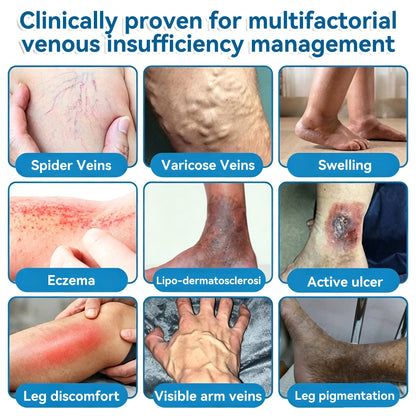 🏆✅️🎈𝐕𝐞𝐢𝐧𝐑𝐞𝐩𝐚𝐢𝐫 𝐌𝐢𝐜𝐫𝐨𝐧𝐞𝐞𝐝𝐥𝐞 𝐏𝐚𝐭𝐜𝐡 𝐑𝐨𝐥𝐥⚡Instant Relief, Long-Term Results