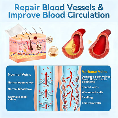 🏆✅️🎈𝐕𝐞𝐢𝐧𝐑𝐞𝐩𝐚𝐢𝐫 𝐌𝐢𝐜𝐫𝐨𝐧𝐞𝐞𝐝𝐥𝐞 𝐏𝐚𝐭𝐜𝐡 𝐑𝐨𝐥𝐥⚡Instant Relief, Long-Term Results